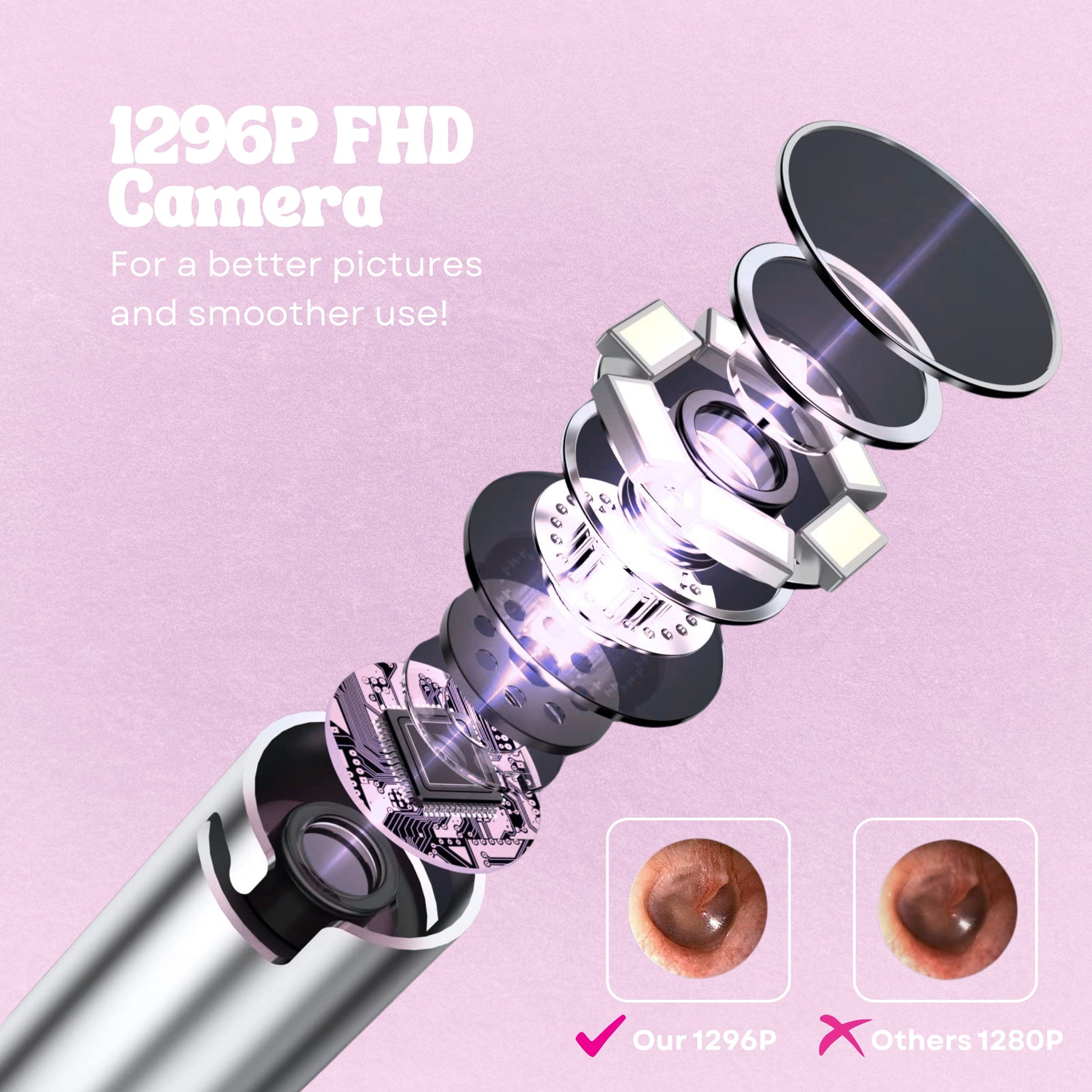 FHD Ear Camera Kit